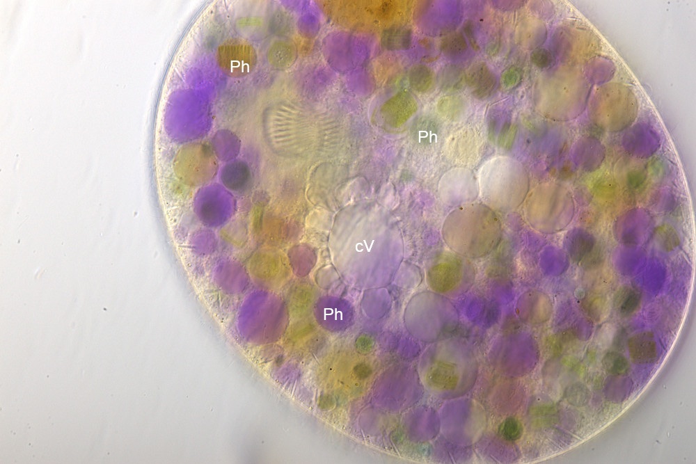 Nassula-spec-vacuole.jpg
