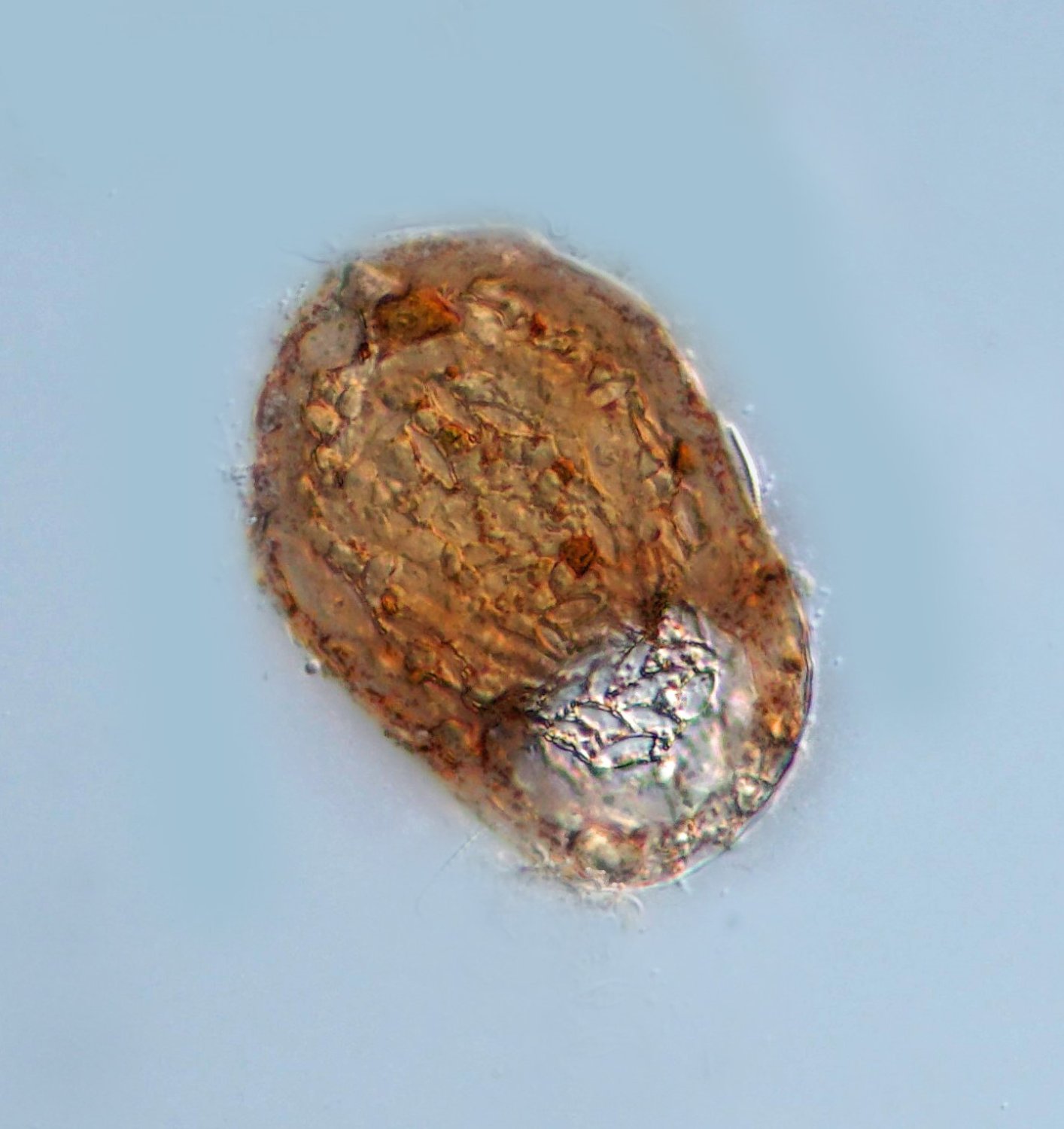 AQ 021 Schalenamöbe .jpg