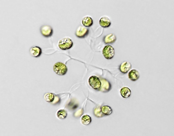 dictyosphaerium.mm5.jpg
