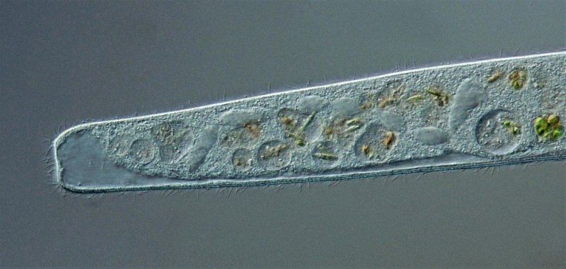 Hier sieht man gut den rosenkranzförmigen Makronucleus und auch die kontraktile Vakuole am Ende, die einen langen dorsalen Sammelkanal hat.