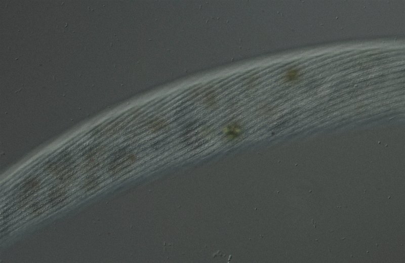 Hier sieht man die Wimperreihen und die Granula.