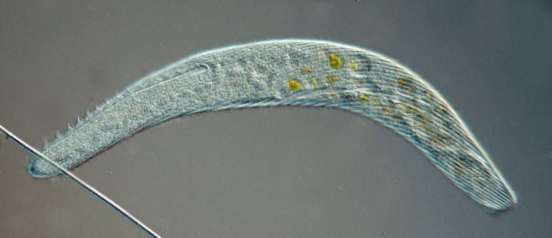 Hier sieht man, dass die adorale Membranellenzone höchsten 30-40% der Körperlänge hat.