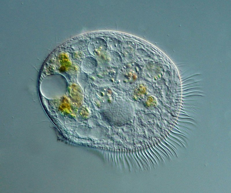 Durchmesser um die 100 Mikrometer.