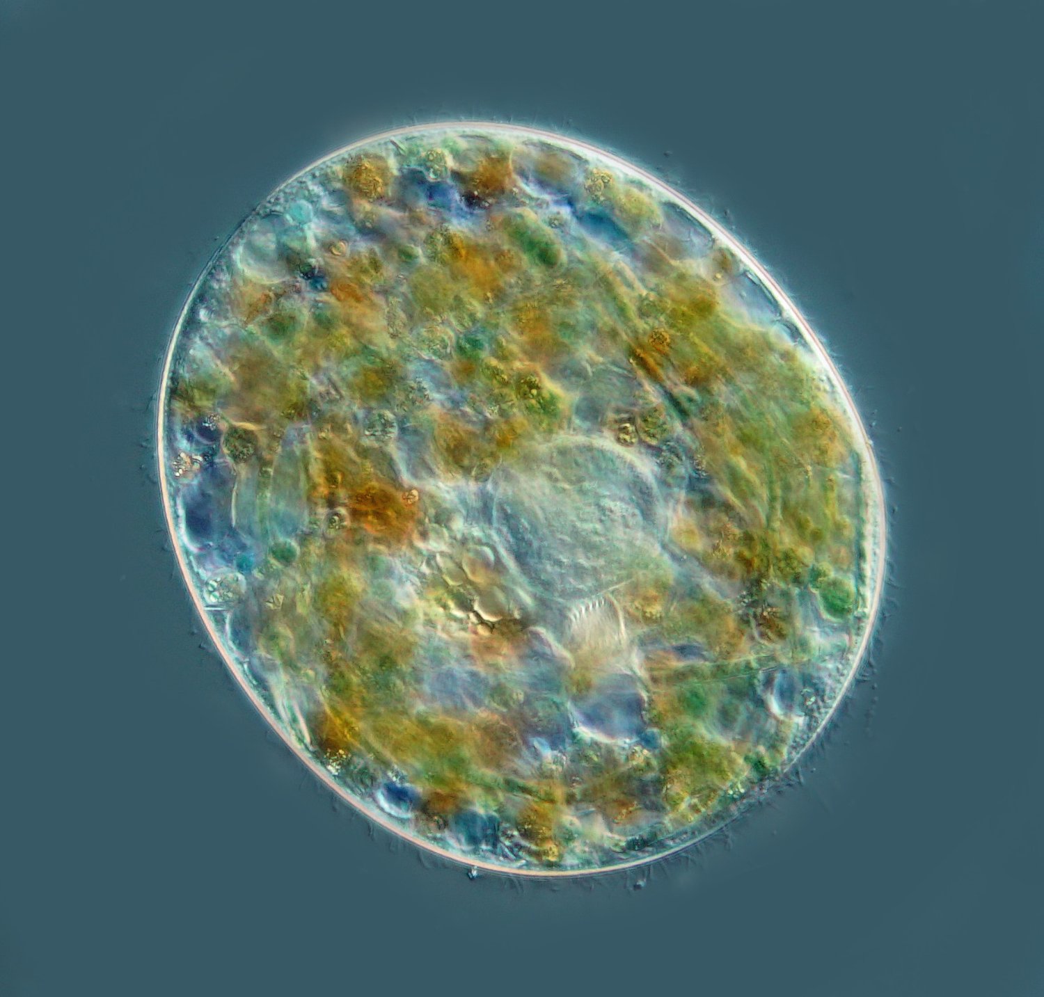 Durchmesser rund 100 Mikrometer.