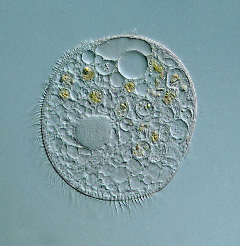 Durchmesser um die 100 Mikrometer.