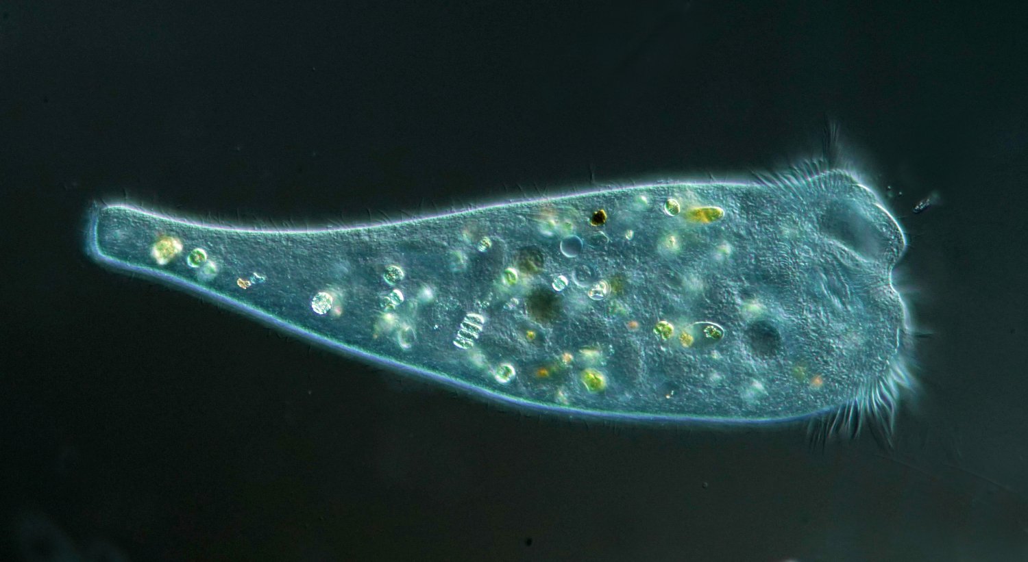 Wenn es S. muelleri ist, dann hat er die Lorica bei der Probenahme eingebüßt. Länge 300-400 Mikrometer.