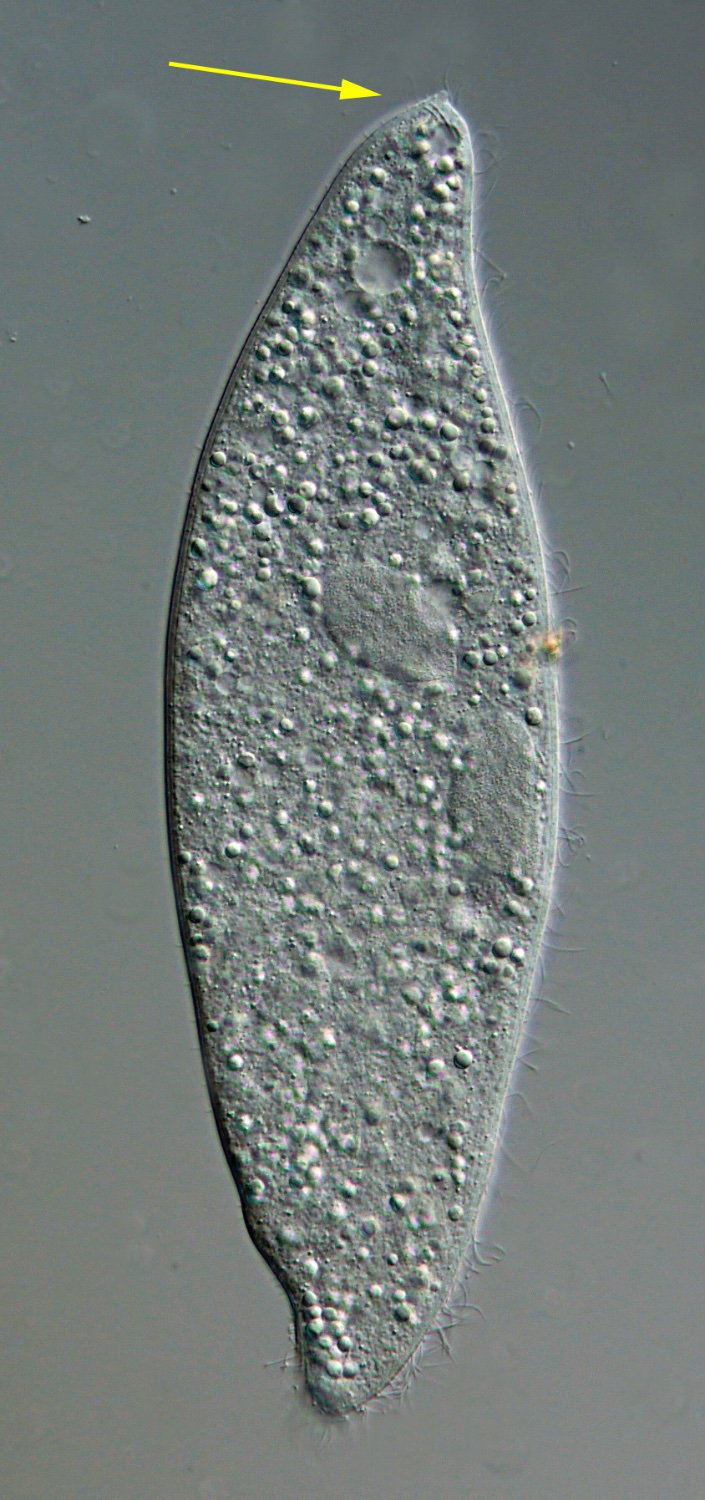 BR Amphileptus sp. 01a.jpg