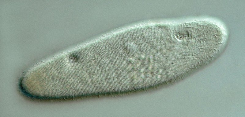 Hier sieht man die Struktur der Cilienreihen.