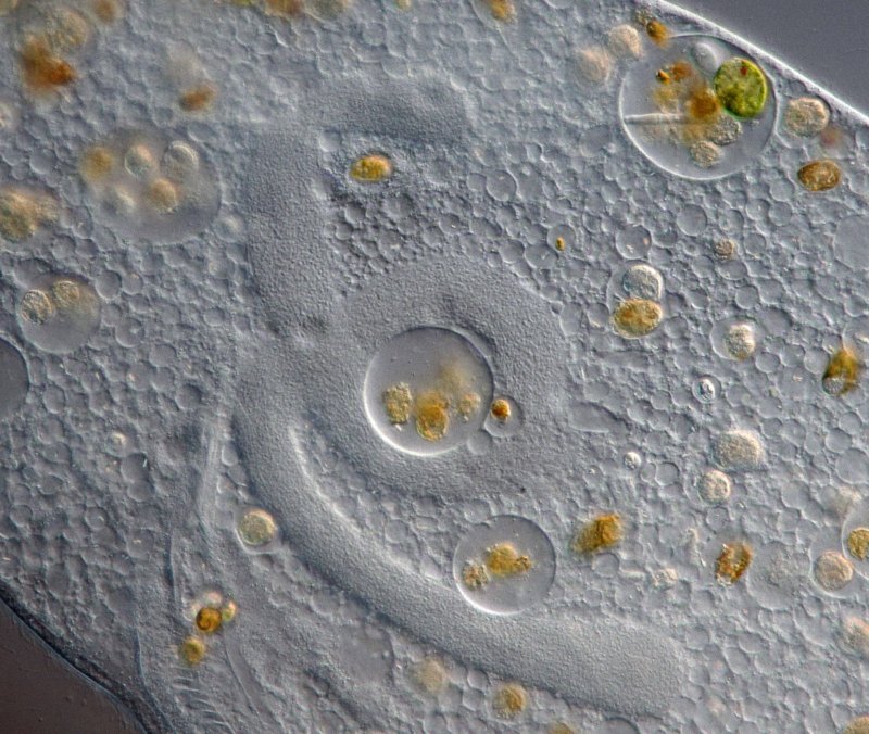 Hier ist sehr deutlich der gewundene Makronucleus zu erkennen.