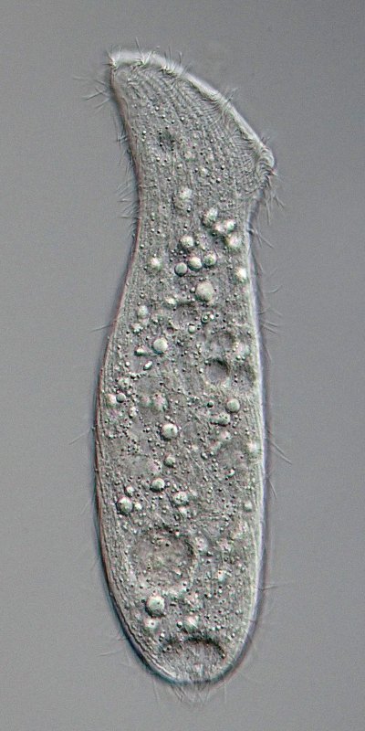 Dies ist eine Übersicht, auf der die Wimperreihen, aber auch die kontraktile Vakuole am Ende gut zu erkennen sind.