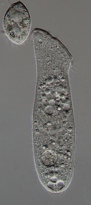 Hier gesellt sich noch ein kleiner Ciliat dazu. Unbestimmt.
