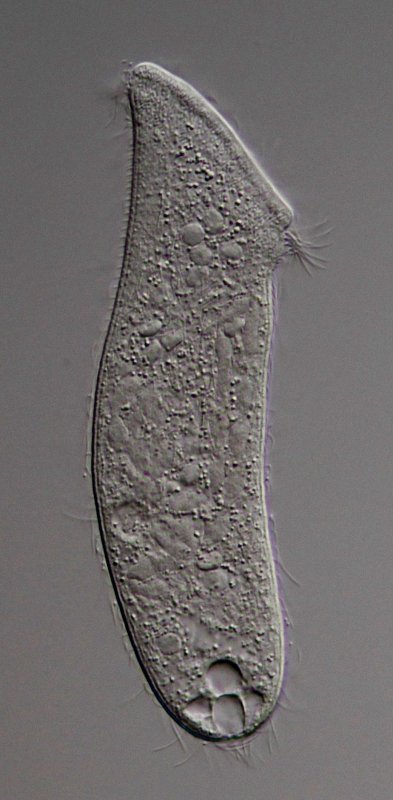 Die kontraktile Vakuole ist am Ende, und in sie ergießen sich kleinere Vakuolen. Die Kernverhältnisse sind sehr unterschiedlich, hier sind es vermutlich viele aufgeknäulte. Vielleicht ist auf diesem Bild die Dorsalbürste auf der linken Seite im oberen Drittel zu erkennen. Zumindest sind dort viele kurze Borsten zu sehen.