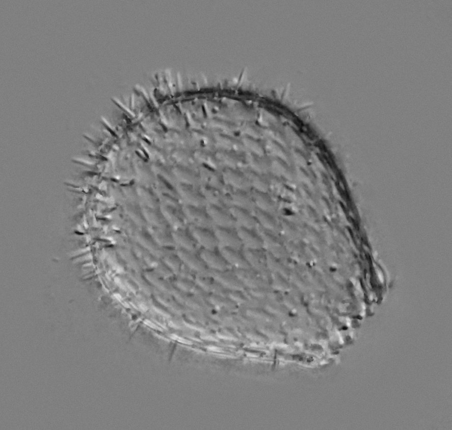 Die Schalenamöbe ist mit Kieselschuppen überzogen und hat kurze Stacheln.