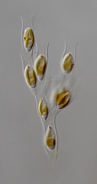 HTO Dinobryon sp 2.jpg